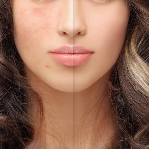 Get Glowing!